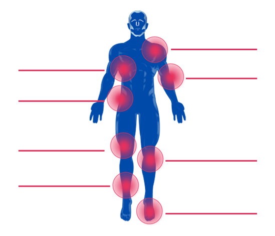 Condition Points