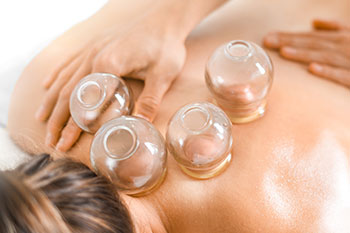 cupping