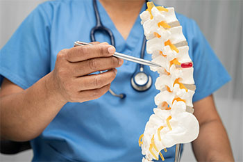 Spinal Degeneration